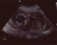 My second scan